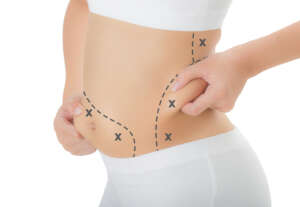 liposcultura addome tunisie